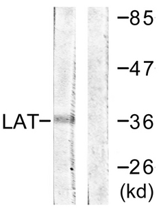 LAT Antibody - Western blot analysis of lysates from A549 cells, using LAT Antibody. The lane on the right is blocked with the synthesized peptide.