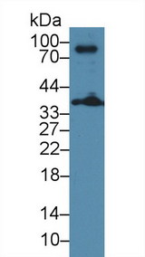 LAT Antibody - Western Blot; Sample: Mouse Thymus lysate; ;Primary Ab: 3µg/ml Rabbit Anti-Mouse LAT Antibody;Second Ab: 0.2µg/mL HRP-Linked Caprine Anti-Rabbit IgG Polyclonal Antibody;