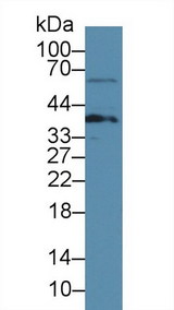 LAT Antibody - Western Blot; Sample: Rat Thymus lysate; ;Primary Ab: 3µg/ml Rabbit Anti-Mouse LAT Antibody;Second Ab: 0.2µg/mL HRP-Linked Caprine Anti-Rabbit IgG Polyclonal Antibody;(Catalog: SAA544Rb19