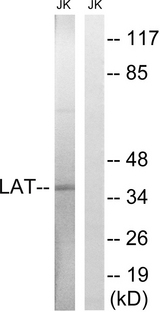 LAT Antibody - Western blot analysis of lysates from Jurkat cells, using LAT Antibody. The lane on the right is blocked with the synthesized peptide.