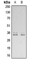 LAT Antibody - Western blot analysis of LAT (pY200) expression in Jurkat UV-treated (A); HeLa UV-treated (B) whole cell lysates.