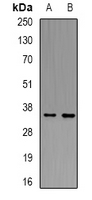 LAT Antibody - Western blot analysis of LAT expression in HEK293T (A); NIH3T3 (B) whole cell lysates.