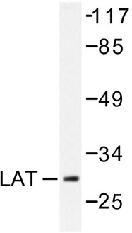 LAT Antibody - Western blot of LAT (L185) pAb in extracts from NIH/3T3 cells treated with 293 UV 5'.