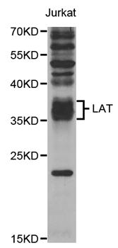 LAT Antibody - Western blot analysis of extracts of Jurkat cells.