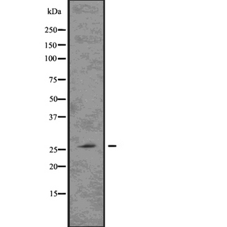 LAT Antibody - Western blot analysis of LAT using Jurkat whole lysates.