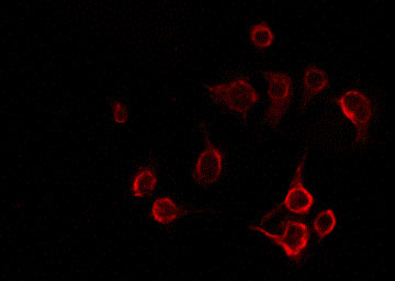 LAT Antibody - Staining NIH-3T3 cells by IF/ICC. The samples were fixed with PFA and permeabilized in 0.1% Triton X-100, then blocked in 10% serum for 45 min at 25°C. The primary antibody was diluted at 1:200 and incubated with the sample for 1 hour at 37°C. An Alexa Fluor 594 conjugated goat anti-rabbit IgG (H+L) Ab, diluted at 1/600, was used as the secondary antibody.