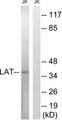 LAT Antibody - Western blot analysis of extracts from Jurkat cells, using LAT (Ab-161) antibody.