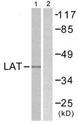 LAT Antibody - Western blot analysis of extracts from A549 cells, using LAT (Ab-171) antibody.