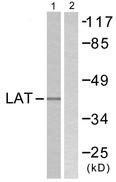 LAT Antibody - Western blot analysis of extracts from A549 cells, using LAT (Ab-171) antibody.