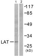 LAT Antibody - Western blot analysis of extracts from NIH/3T3 cells, using LAT (Ab-191) antibody.