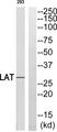 LAT Antibody - Western blot analysis of extracts from 293 cells, using LAT (Ab-255) Antibody.