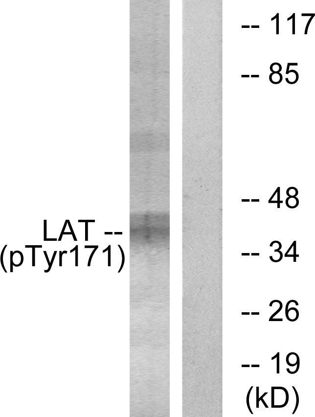 LAT Antibody - Western blot analysis of lysates from Jurkat cells treated with UV 15', using LAT (Phospho-Tyr171) Antibody. The lane on the right is blocked with the phospho peptide.