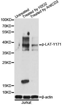 LAT Antibody - Western blot analysis of extracts of Jurkat cells, using Phospho-LAT-Y171 antibody at 1:1000 dilution. Jurkat cells were treated by Hydrogen Peroxide (2mM) for 2 minutes after serum-starvation overnight or treated by CD-3 (10 ug/mL) for 2 minutes after serum-starvation overnight. The secondary antibody used was an HRP Goat Anti-Rabbit IgG (H+L) at 1:10000 dilution. Lysates were loaded 25ug per lane and 3% nonfat dry milk in TBST was used for blocking. Blocking buffer: 3% BSA.An ECL Kit was used for detection and the exposure time was 5s.