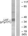 LAT Antibody - Western blot analysis of extracts from Jurkat cells, treated with UV (5mins), using LAT (Phospho-Tyr171) antibody.