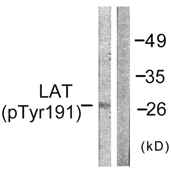 LAT Antibody - Western blot analysis of lysates from NIH/3T3 cells, using LAT (Phospho-Tyr191) Antibody. The lane on the right is blocked with the phospho peptide.