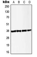 LAT Antibody - Western blot analysis of LAT (pY191) expression in HeLa PMA-treated (A); Jurkat CD3-treated (B); Raw264.7 PMA-treated (C); PC12 PMA-treated (D) whole cell lysates.