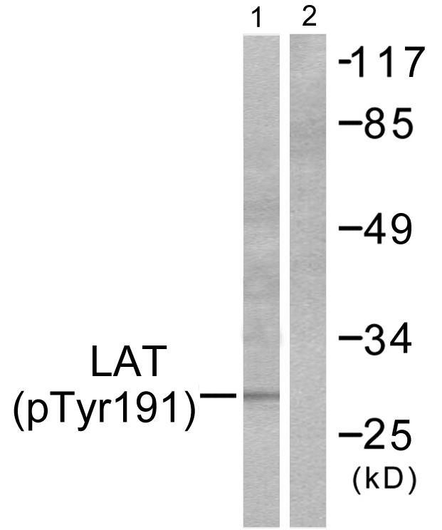 LAT Antibody - Western blot analysis of extracts from NIH/3T3 cells, using LAT (Phospho-Tyr191) antibody.