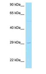 LAT2 / NTAL Antibody - LAT2 / NTAL antibody Western Blot of RPMI-8226.  This image was taken for the unconjugated form of this product. Other forms have not been tested.
