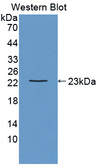 LAT2 / NTAL Antibody - Western blot of LAT2 / NTAL antibody.