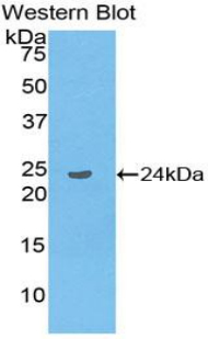 LAT2 / NTAL Antibody - Western blot of recombinant LAT2 / NTAL.  This image was taken for the unconjugated form of this product. Other forms have not been tested.