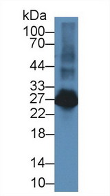 LAT2 / NTAL Antibody - Western Blot; Sample: Rat Spleen lysate; Primary Ab: 2µg/ml Rabbit Anti-Rat LAT2 Antibody Second Ab: 0.2µg/mL HRP-Linked Caprine Anti-Rabbit IgG Polyclonal Antibody