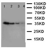 LAT2 / NTAL Antibody - WB of LAT2 / NTAL antibody. Recombinant Protein Detection Source:. E.coli derived -recombinant Human LAT2, 37.8KD. (162aa tag+ M1-A182). Lane 1: Recombinant Human LAT2 Protein 10ng. Lane 2: Recombinant Human LAT2 Protein 5ng. Lane 3: Recombinant Human LAT2 Protein 2.5ng. Lane 4: Recombinant Human LAT2 Protein 1.25ng.