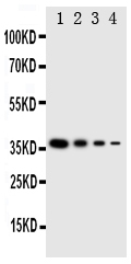 LAT2 / NTAL Antibody - Anti-NTAL antibody, Western blottingRecombinant Protein Detection Source: E. coli derived -recombinant Human LAT2, 37. 8KD (162aa tag+ M1-A182)Lane 1: Recombinant Human LAT2 Protein 10ng Lane 2: Recombinant Human LAT2 Protein 5ng Lane 3: Recombinant Human LAT2 Protein 2. 5ng Lane 4: Recombinant Human LAT2 Protein 1. 25ng