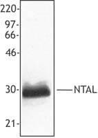 LAT2 / NTAL Antibody - Extracts from peripheral blood mononuclear cells were resolved by electrophoresis, transferred to nitrocellulose, and probed with mouse monoclonal antibody against NTAL. Proteins were visualized using a goat anti-mouse secondary conjugated to HRP and a ch