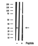 LAT2 / NTAL Antibody - Western blot analysis of extracts of human peripheral lymphocytes tissue sample using LAB antibody.
