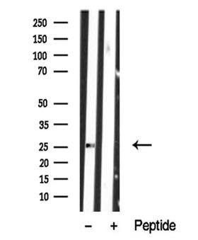 LAT2 / NTAL Antibody - Western blot analysis of extracts of human peripheral lymphocytes tissue sample using LAB antibody.