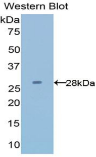 Latexin / MUM Antibody - Western blot of recombinant Latexin / MUM.  This image was taken for the unconjugated form of this product. Other forms have not been tested.