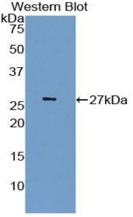 Latexin / MUM Antibody - Western blot of recombinant Latexin / MUM.