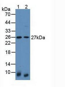 Latexin / MUM Antibody - Western Blot; Sample: Lane1: Mouse Lung Tissue; Lane2: Human Hela Cells.