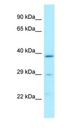 Latexin / MUM Antibody - Latexin / MUM antibody Western Blot of MCF7.  This image was taken for the unconjugated form of this product. Other forms have not been tested.