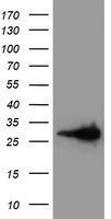 Latexin / MUM Antibody - HEK293T cells were transfected with the pCMV6-ENTRY control (Left lane) or pCMV6-ENTRY LXN (Right lane) cDNA for 48 hrs and lysed. Equivalent amounts of cell lysates (5 ug per lane) were separated by SDS-PAGE and immunoblotted with anti-LXN.