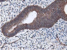 Latexin / MUM Antibody - IHC of paraffin-embedded Human endometrium tissue using anti-LXN mouse monoclonal antibody.