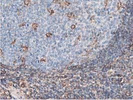 Latexin / MUM Antibody - IHC of paraffin-embedded Human lymph node tissue using anti-LXN mouse monoclonal antibody.