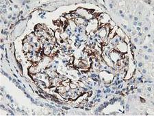 Latexin / MUM Antibody - IHC of paraffin-embedded Human Kidney tissue using anti-LXN mouse monoclonal antibody.