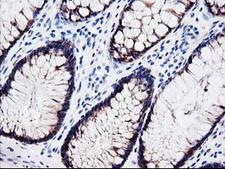 Latexin / MUM Antibody - IHC of paraffin-embedded Human colon tissue using anti-LXN mouse monoclonal antibody.