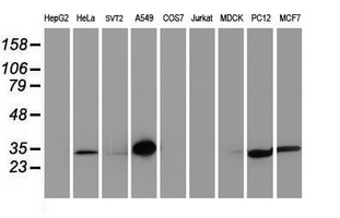 Latexin / MUM Antibody - Western blot of extracts (35 ug) from 9 different cell lines by using anti-LXN monoclonal antibody.