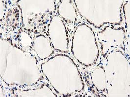 Latexin / MUM Antibody - IHC of paraffin-embedded Human thyroid tissue using anti-LXN mouse monoclonal antibody.