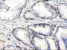 Latexin / MUM Antibody - IHC of paraffin-embedded Human prostate tissue using anti-LXN mouse monoclonal antibody.