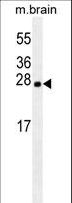Latexin / MUM Antibody - LXN antibody western blot of mouse brain tissue lysates (35 ug/lane). The LXN antibody detected the LXN protein (arrow).