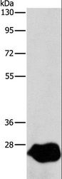 Latexin / MUM Antibody - Western blot analysis of A549 cell, using LXN Polyclonal Antibody at dilution of 1:667.