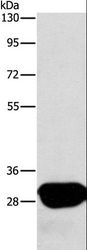 Latexin / MUM Antibody - Western blot analysis of A549 cell, using LXN Polyclonal Antibody at dilution of 1:667.