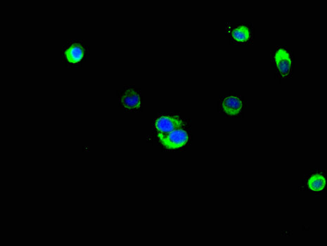 Latexin / MUM Antibody - Immunofluorescent analysis of Hela cells using LXN Antibody at a dilution of 1:100 and Alexa Fluor 488-congugated AffiniPure Goat Anti-Rabbit IgG(H+L)