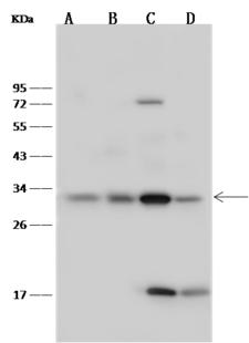 Latexin / MUM Antibody - Anti-LXN rabbit polyclonal antibody at 1:500 dilution. Lane A: A549 Whole Cell Lysate. Lane B: Hela Whole Cell Lysate. Lane C: MCF7 Whole Cell Lysate. Lane D: HL60 Whole Cell Lysate. Lysates/proteins at 30 ug per lane. Secondary: Goat Anti-Rabbit IgG (H+L)/HRP at 1/10000 dilution. Developed using the ECL technique. Performed under reducing conditions. Predicted band size: 26 kDa. Observed band size: 33 kDa.