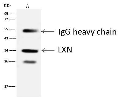 Latexin / MUM Antibody - LXN was immunoprecipitated using: Lane A: 0.5 mg MCF7 Whole Cell Lysate. 4 uL anti-LXN rabbit polyclonal antibody and 60 ug of Immunomagnetic beads Protein A/G. Primary antibody: Anti-LXN rabbit polyclonal antibody, at 1:100 dilution. Secondary antibody: Goat Anti-Rabbit IgG (H+L)/HRP at 1/10000 dilution. Developed using the ECL technique. Performed under reducing conditions. Predicted band size: 26 kDa. Observed band size: 34 kDa.