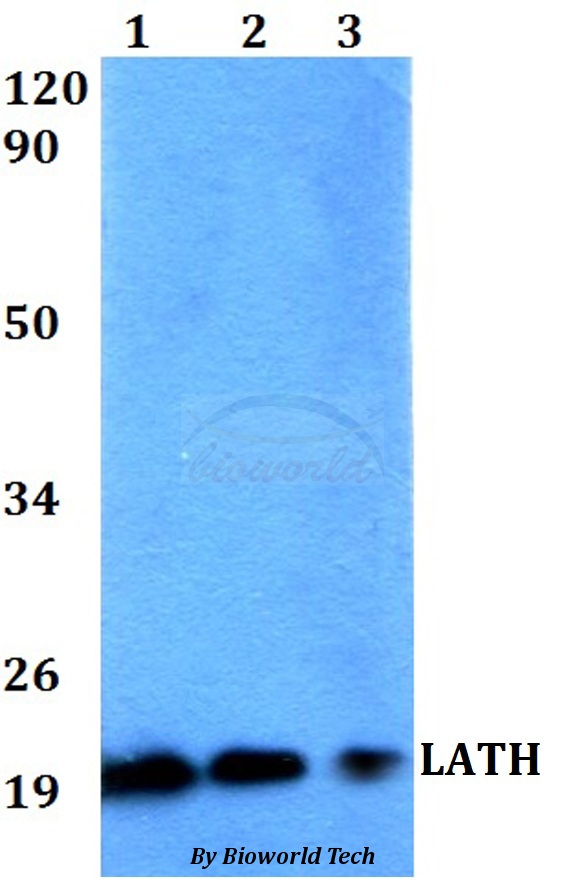 LATH Antibody - Western blot of LATH antibody at 1:500 dilution. Lane 1: HEK293T whole cell lysate. Lane 2: Raw264.7 whole cell lysate. Lane 3: PC12 whole cell lysate.