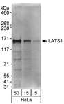 LATS1 Antibody - Detection of Human LATS1 by Western Blot. Samples: Whole cell lysate (5, 15 and 50 ug) from HeLa cells. Antibodies: Affinity purified rabbit anti-LATS1 antibody used for WB at 0.1 ug/ml. Detection: Chemiluminescence with an exposure time of 30 seconds.
